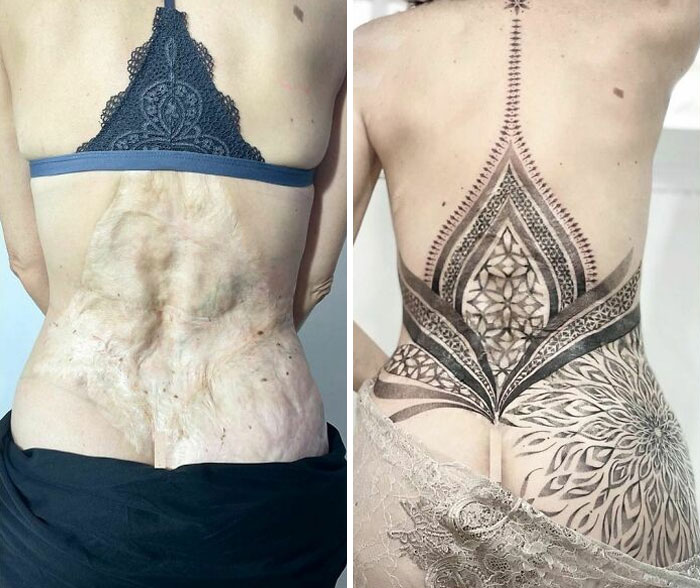 50 Times People Asked Tattoo Artists To Cover Up Their Scars And Birthmarks And Couldnt Be Happier With The Result