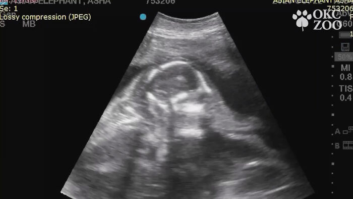  ultrasound over year elephant 