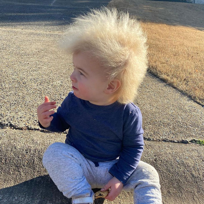 Happy Toddler Diagnosed With Uncombable Hair Syndrome Shows There Is No Such Thing As A Bad Hair Day