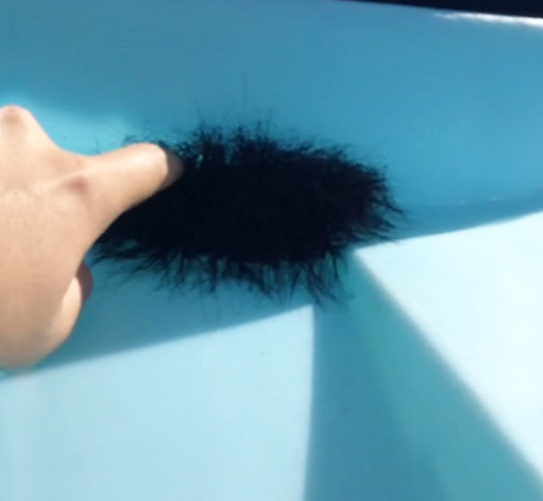 Why You Should Never Poke Random Balls Of Hair