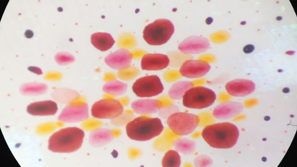 A Squid Listening to Cypress Hill A Squid Listening to Cypress Hill