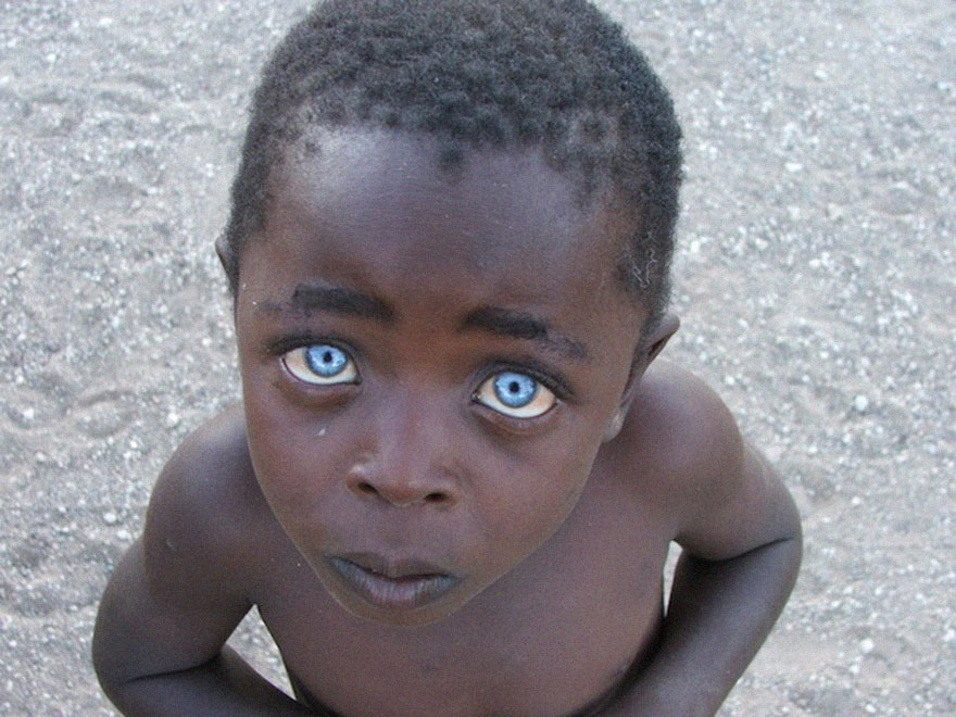21 Powerful Photos Of People's Eyes That Say More Than Words Ever Could 21 Powerful Photos Of People's Eyes That Say More Than Words Ever Could