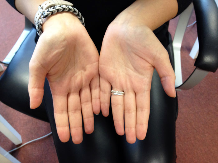 Skirmante (Vilnius, Lithuania)