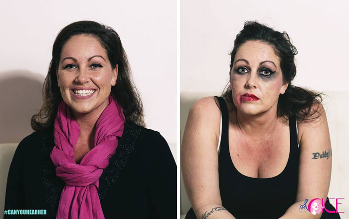 Social Campaign To Raise Awareness About Women Who Went Through The Brutality Of Sex Trafficking