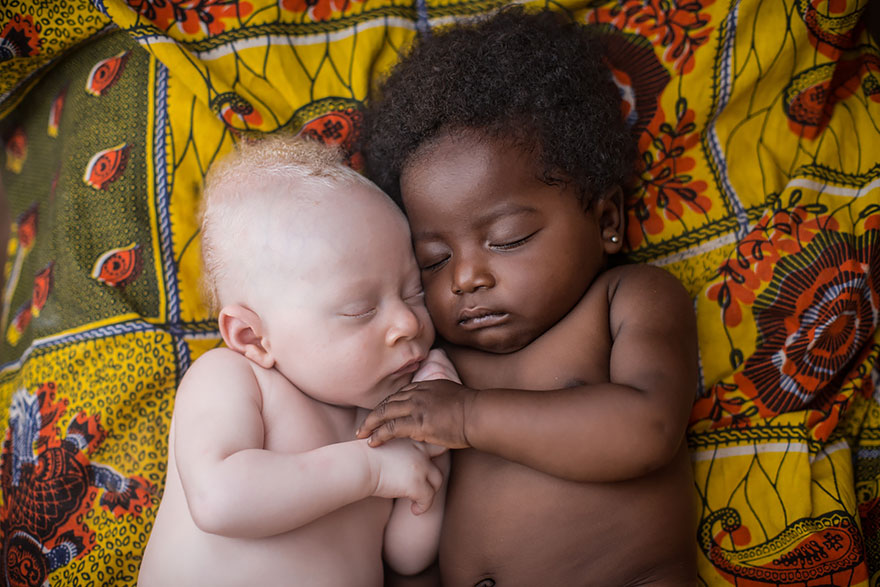 Black Baby Holding An Albino Baby