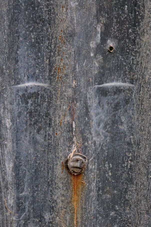 Got Shot In The Head.