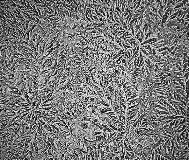 It Matters Why You Cry - Different Types Of Tears.