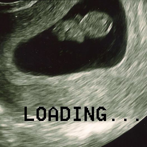 Picdate: March 23rd, 2014. D.o.b.: October 20th, 2014.