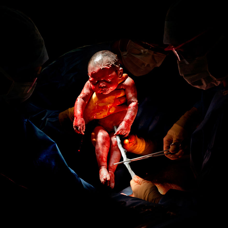 newborn-infant-photos-c-section-cesar-christian-berthelot-1 newborn-infant-photos-c-section-cesar-christian-berthelot-1