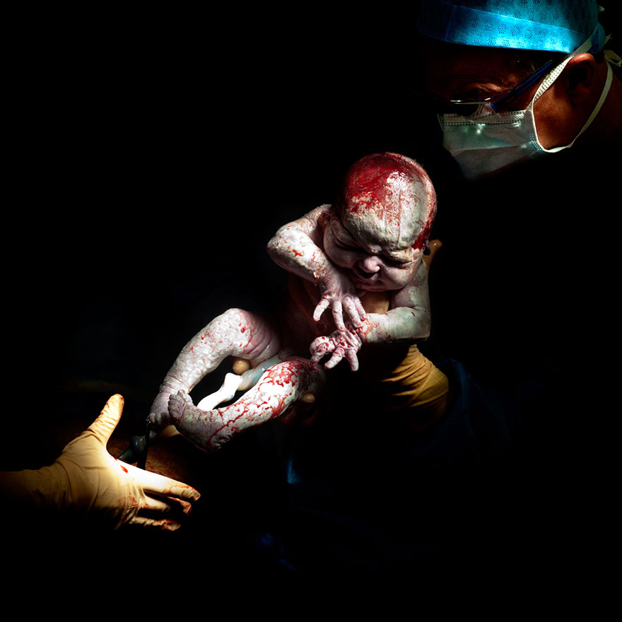 newborn-infant-photos-c-section-cesar-christian-berthelot-2 newborn-infant-photos-c-section-cesar-christian-berthelot-2