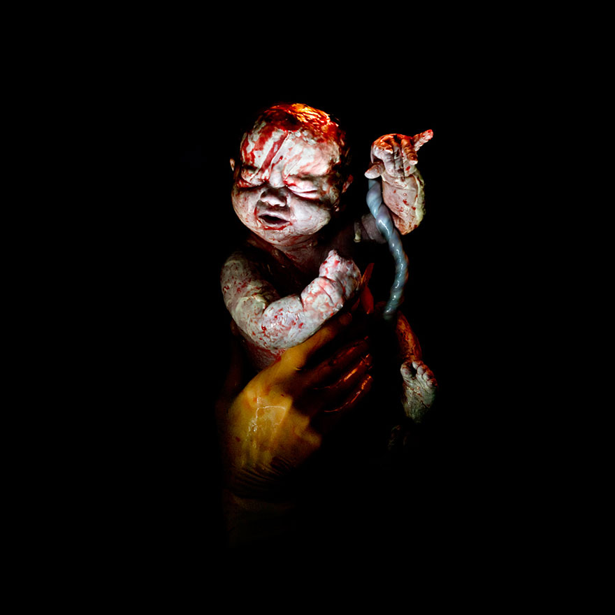 newborn-infant-photos-c-section-cesar-christian-berthelot-5 newborn-infant-photos-c-section-cesar-christian-berthelot-5