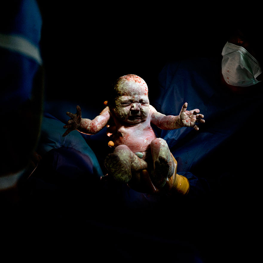 newborn-infant-photos-c-section-cesar-christian-berthelot-8 newborn-infant-photos-c-section-cesar-christian-berthelot-8