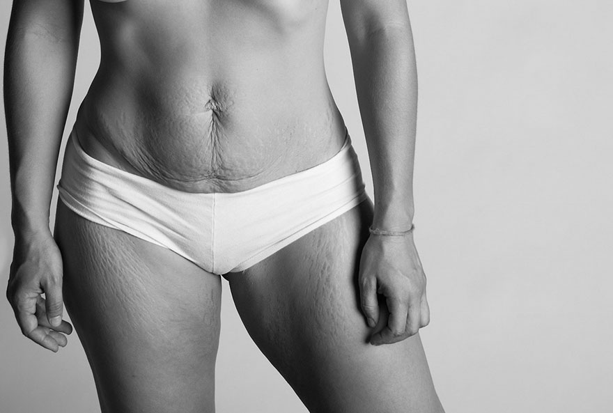 postpartum-photography-mothers-after-pregnancy-beautiful-body-project-jade-beall-4 postpartum-photography-mothers-after-pregnancy-beautiful-body-project-jade-beall-4