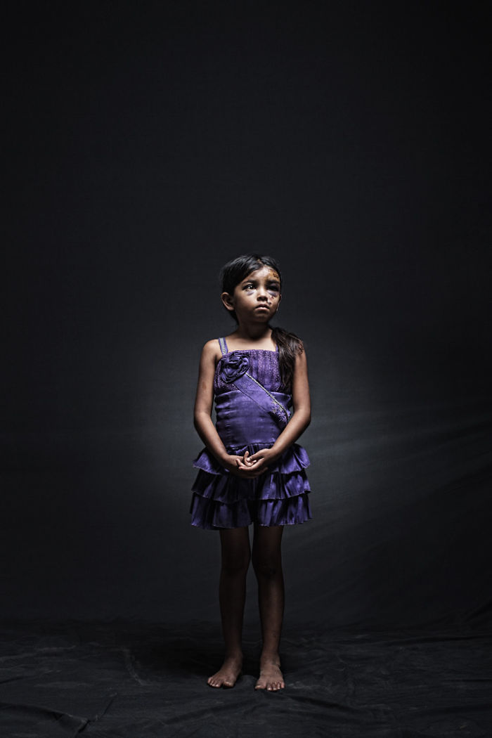The Other Side Of The American Dream: Portraits Of Migrants Who Suffered When Entering The US The Other Side Of The American Dream: Portraits Of Migrants Who Suffered When Entering The US