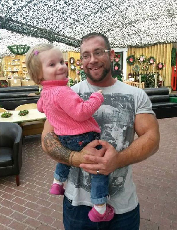 Parents Tattoo Their Legs With Daughter’s Birthmark So She Won’t Feel Different