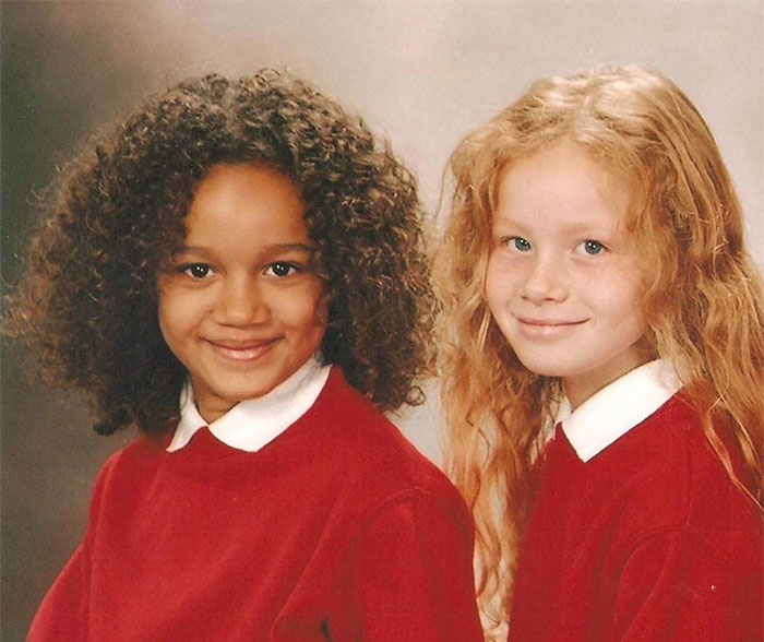 black-white-skin-twin-sisters-lucy-maria-aylmer-18 black-white-skin-twin-sisters-lucy-maria-aylmer-18