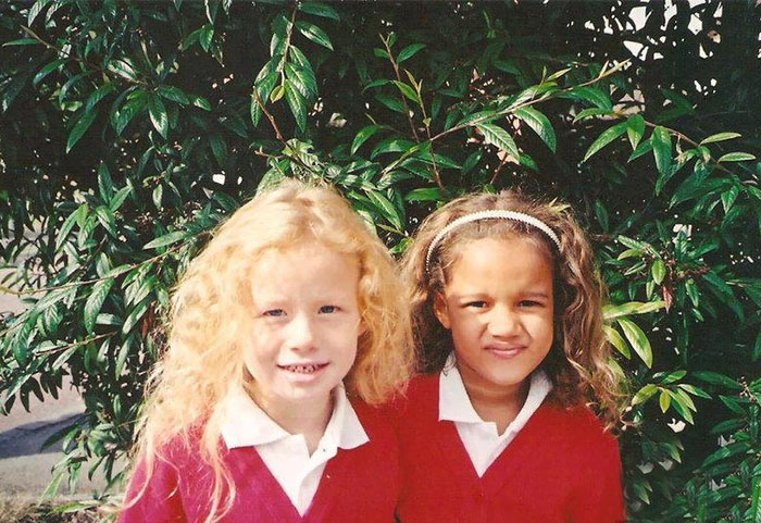 black-white-skin-twin-sisters-lucy-maria-aylmer-21 black-white-skin-twin-sisters-lucy-maria-aylmer-21