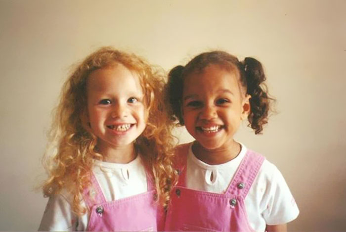 black-white-skin-twin-sisters-lucy-maria-aylmer-8 black-white-skin-twin-sisters-lucy-maria-aylmer-8