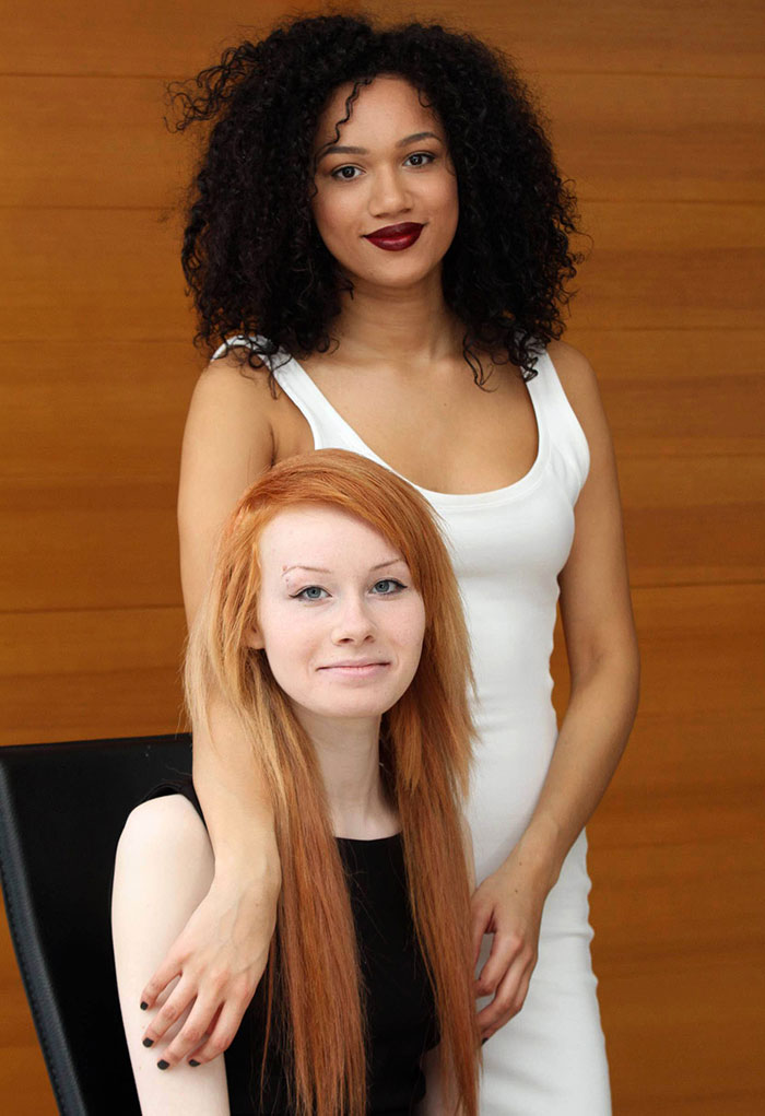 black-white-skin-twin-sisters-lucy-maria-aylmer-9 black-white-skin-twin-sisters-lucy-maria-aylmer-9
