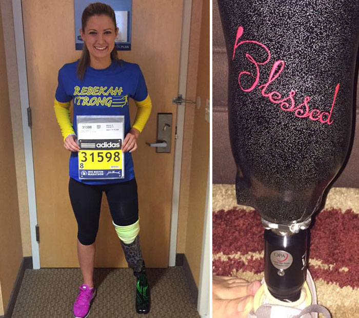 Boston Bombing Survivor Will Run In Marathon Again With Her New Prosthetic Leg
