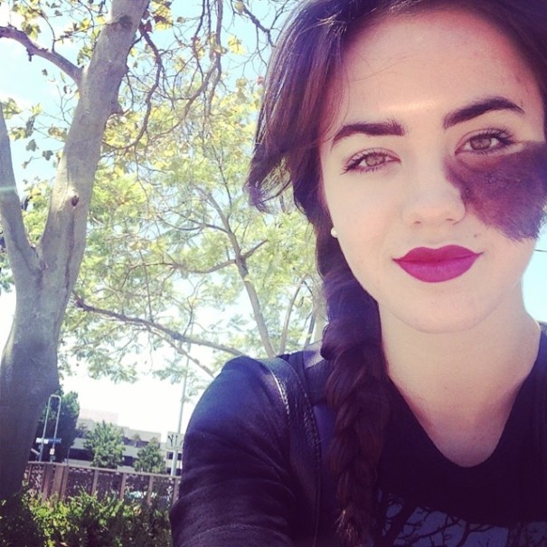 Selfie of dancer Cassandra Naud with birthmark under her left eye