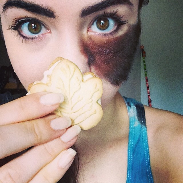 People Told Her To Remove Her Birthmark, But She Chose To Embrace It Instead