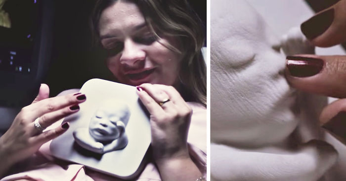 Blind Pregnant Woman ‘Sees’ Her Unborn Baby For The First Time With 3D Printing