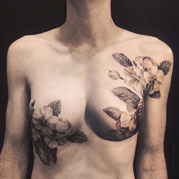 Breast cancer survivor with floral tattoos covering mastectomy scars.