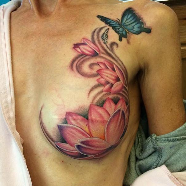 Beautiful tattoo covering a breast cancer survivor's mastectomy scar, featuring flowers and a butterfly.