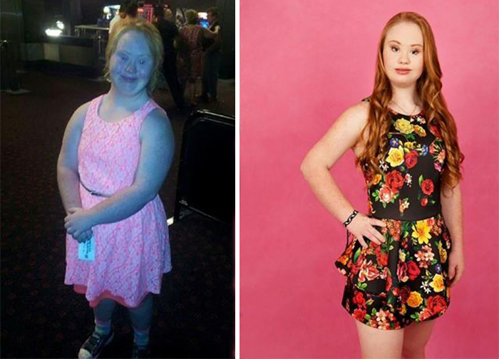 down-syndrome-model-madeline-stuart-australia-15 down-syndrome-model-madeline-stuart-australia-15