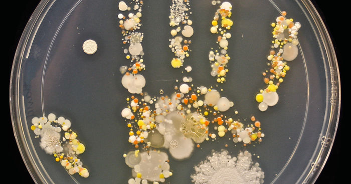 Microbes On 8-Year-Old Boy’s Handprint After Playing Outside