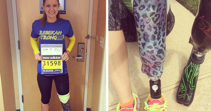 Boston Bombing Survivor Will Run In Marathon Again With Her New Prosthetic Leg