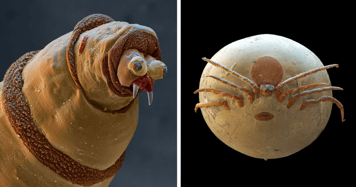 Post Your Best Pictures Of Microscopic World