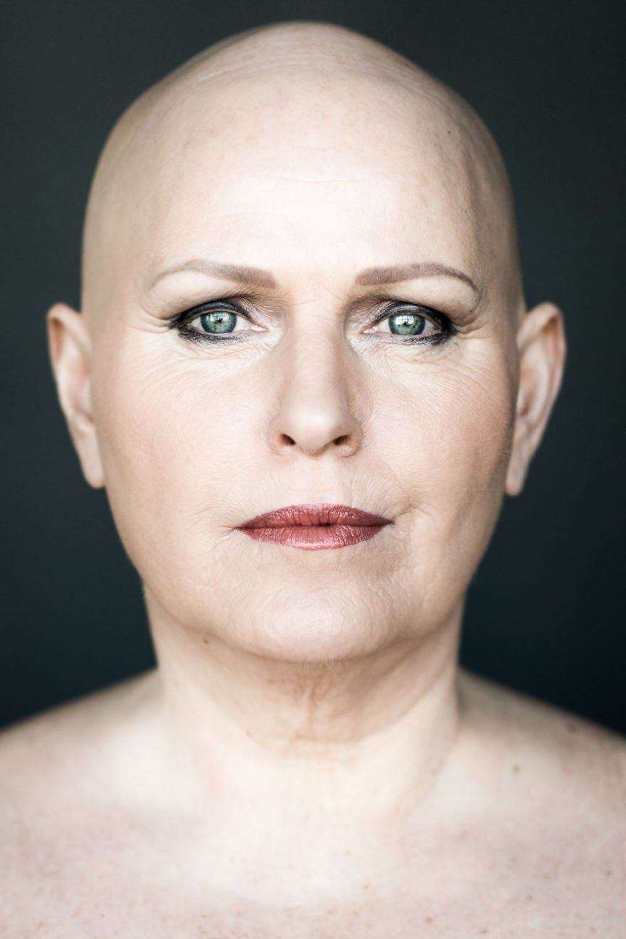 Baldvin: I Photograph Women With Alopecia To Break Gender Stereotypes Baldvin: I Photograph Women With Alopecia To Break Gender Stereotypes