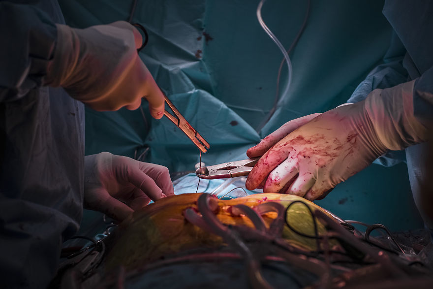 Gentle Violence: A Visual Exploration Of The Body During Open Heart Surgeries