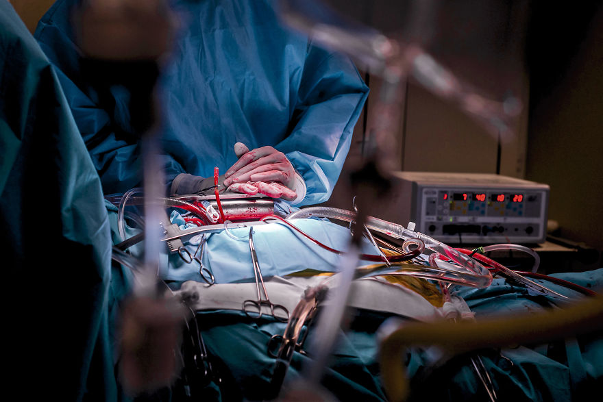 Gentle Violence: A Visual Exploration Of The Body During Open Heart Surgeries Gentle Violence: A Visual Exploration Of The Body During Open Heart Surgeries