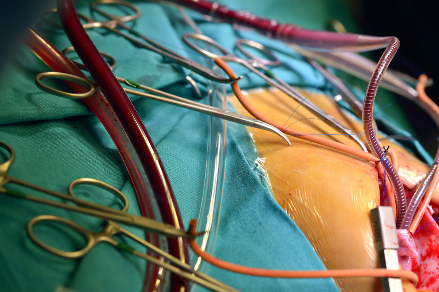 Gentle Violence: A Visual Exploration Of The Body During Open Heart Surgeries Gentle Violence: A Visual Exploration Of The Body During Open Heart Surgeries