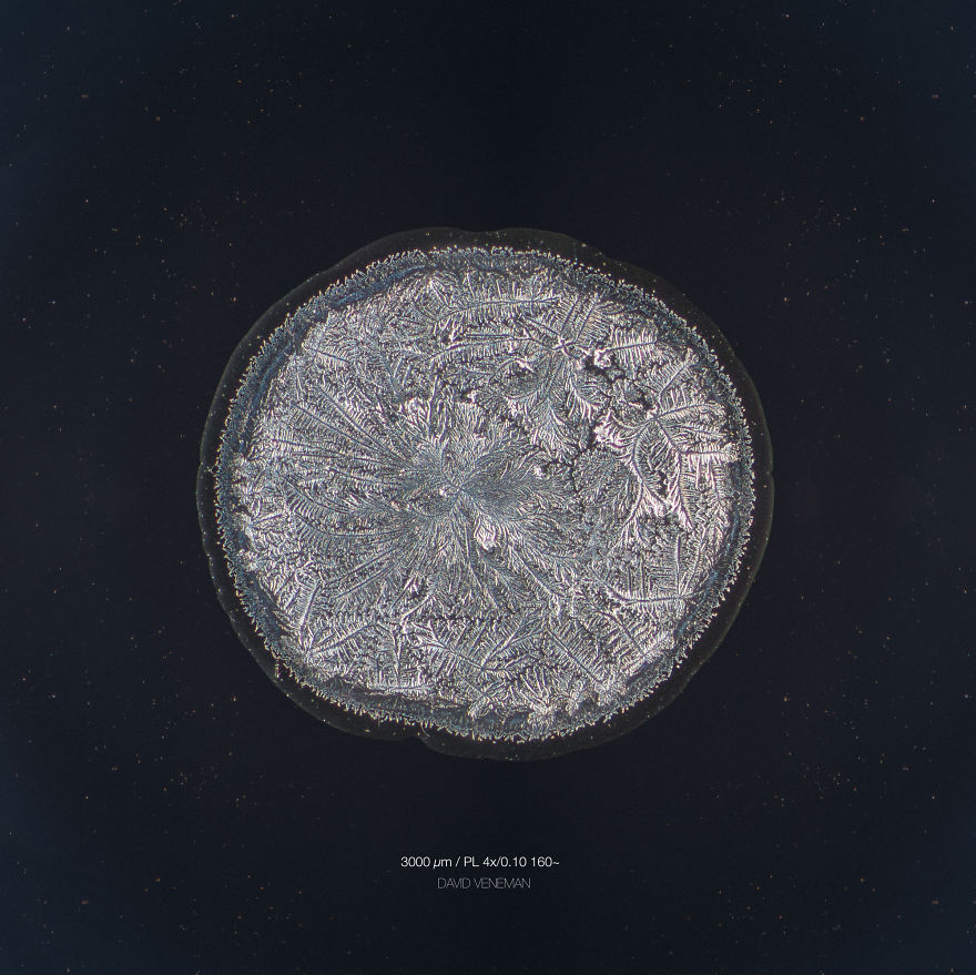 I Photograph Tears To Show That Each Tear Is Unique And Beautiful