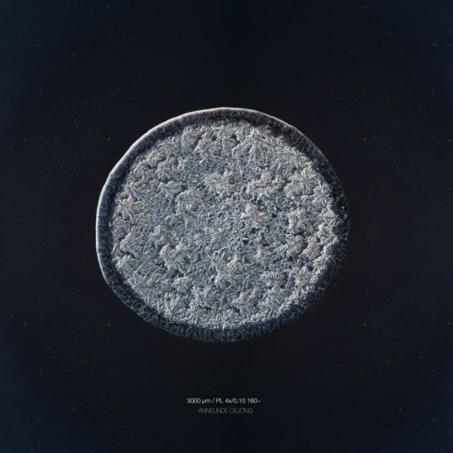 I Photograph Tears To Show That Each Tear Is Unique And Beautiful