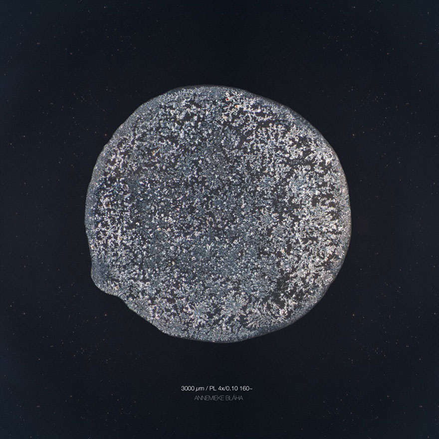 I Photograph Tears To Show That Each Tear Is Unique And Beautiful