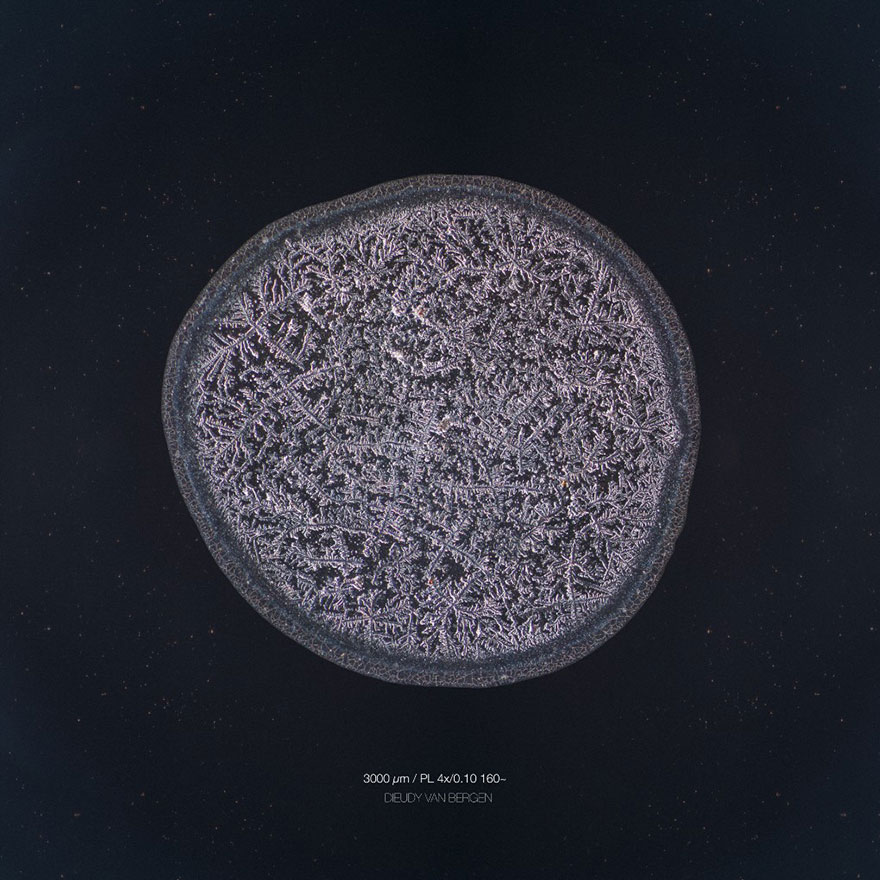 I Photograph Tears To Show That Each Tear Is Unique And Beautiful