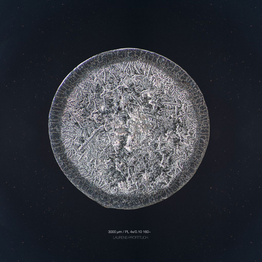 I Photograph Tears To Show That Each Tear Is Unique And Beautiful