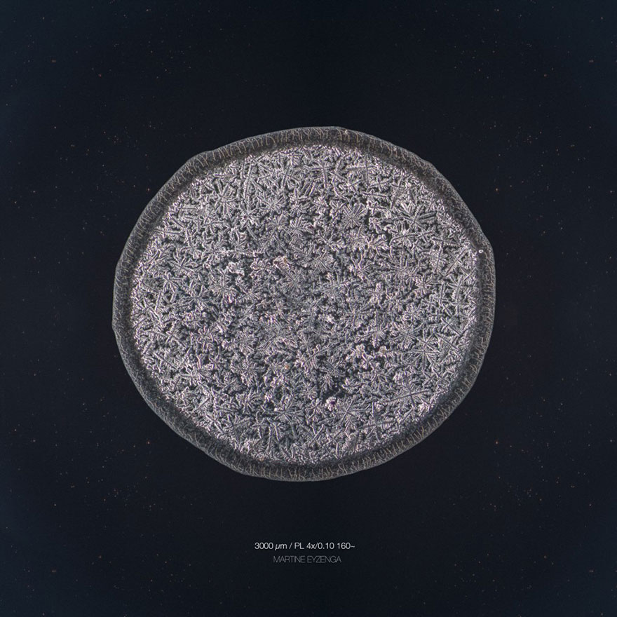 I Photograph Tears To Show That Each Tear Is Unique And Beautiful