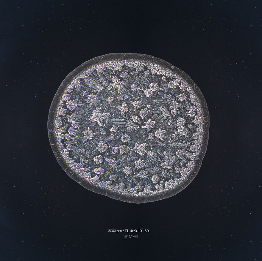 I Photograph Tears To Show That Each Tear Is Unique And Beautiful