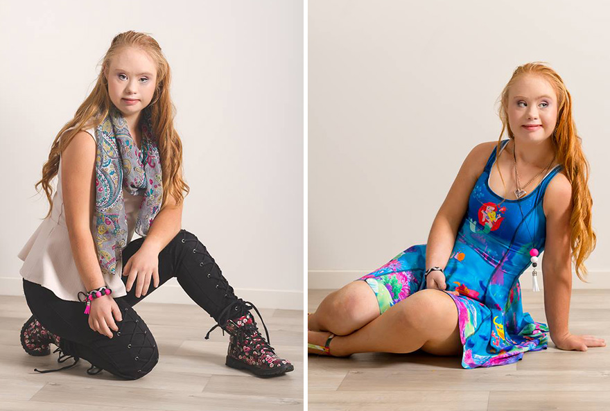 down-syndrome-model-job-madeline-stuart-australia-2 down-syndrome-model-job-madeline-stuart-australia-2