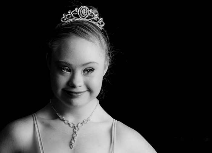A Teen With Down Syndrome Just Landed A Modelling Contract