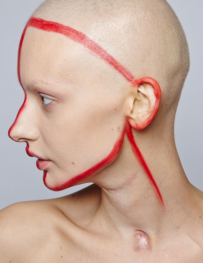 jaw-cancer-model-19 jaw-cancer-model-19