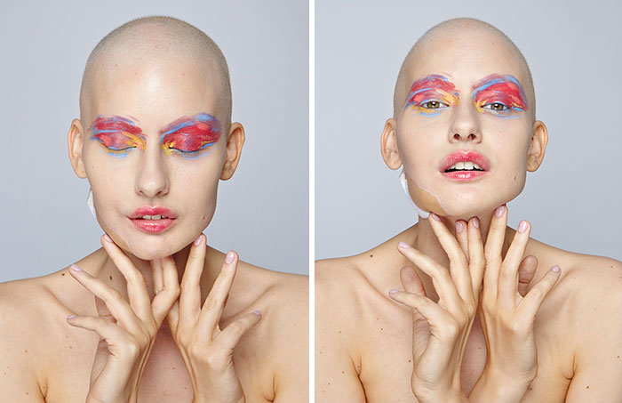 jaw-cancer-model-21 jaw-cancer-model-21