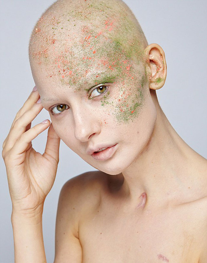 jaw-cancer-model-32 jaw-cancer-model-32