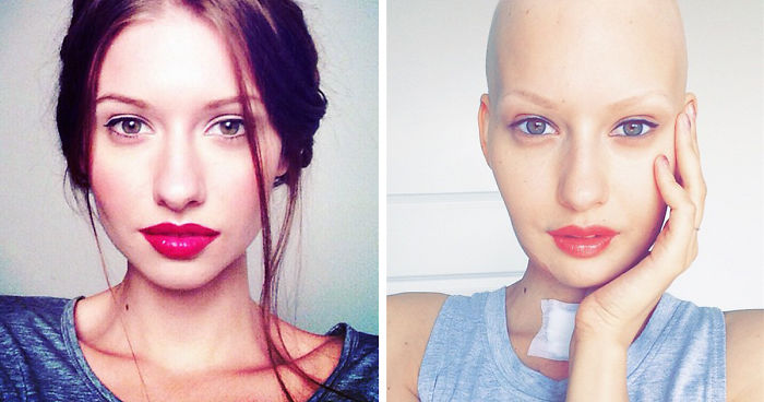 Doctors Told Model To Abort Her Child After She Lost 95% Of Her Jaw To Cancer. This Is What She Did